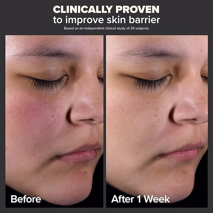 BHA Liquid Exfoliant